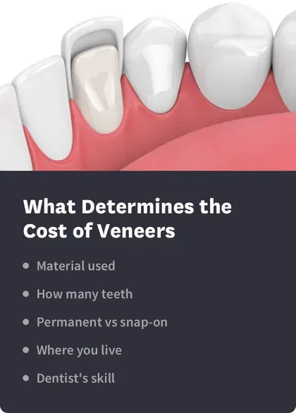 what determines the cost of veneers