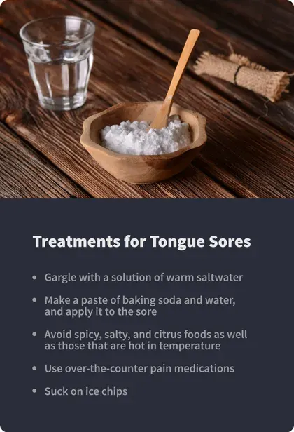 treatment for tongue sores