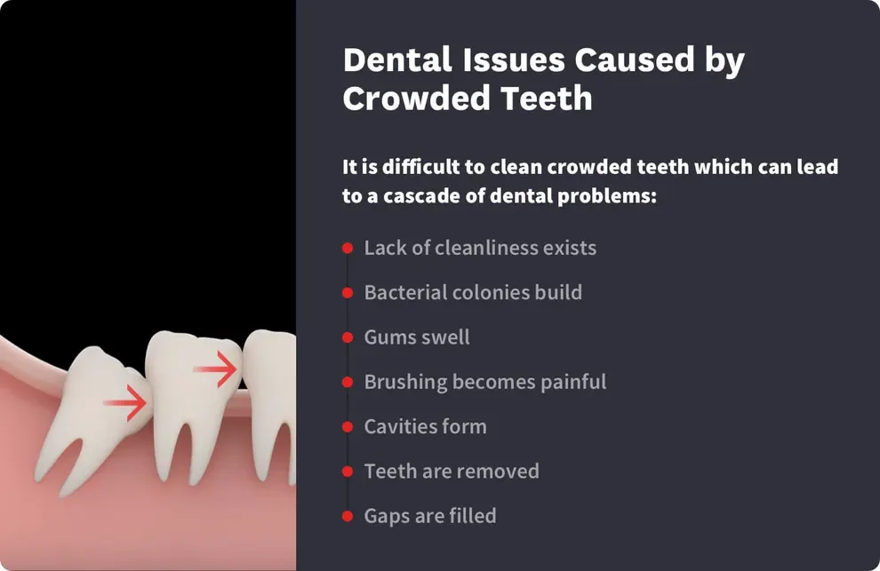 Crowded Teeth Pain, Headaches & Risks Byte®
