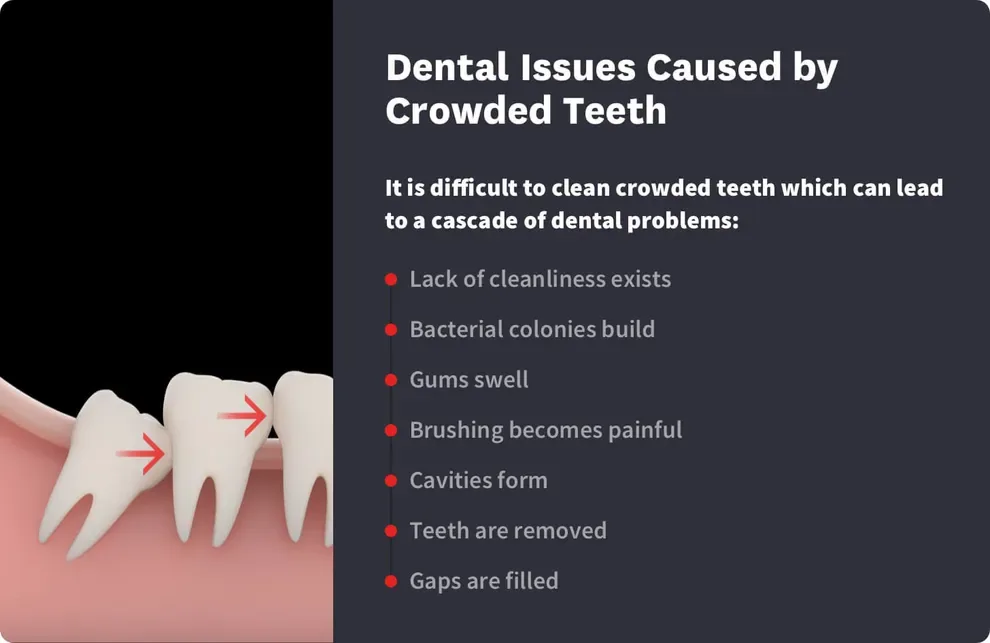 dental issues caused by crowded teeth