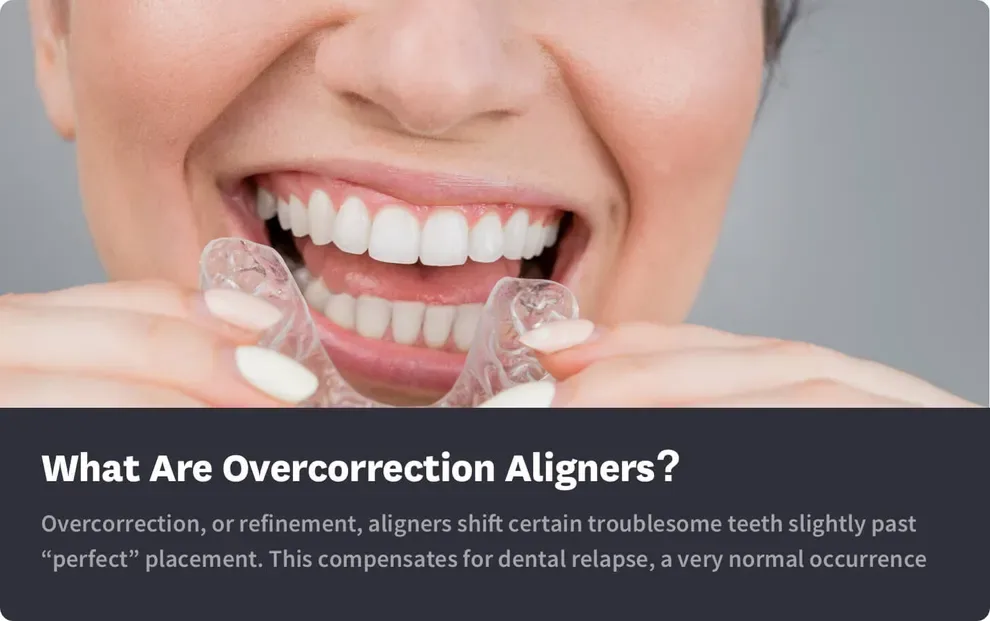 What Are Overcorrection Aligners