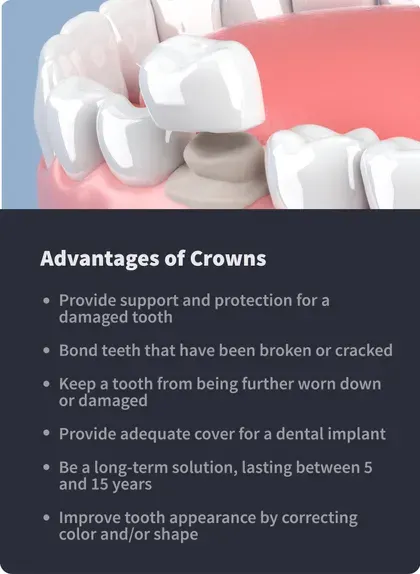 Advantages of Crowns