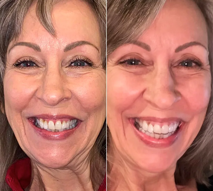 Byte Protection Plan Byte®