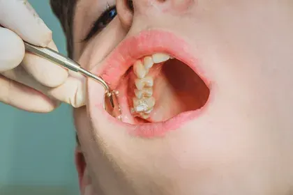 Person Getting Teeth and Gums Examined