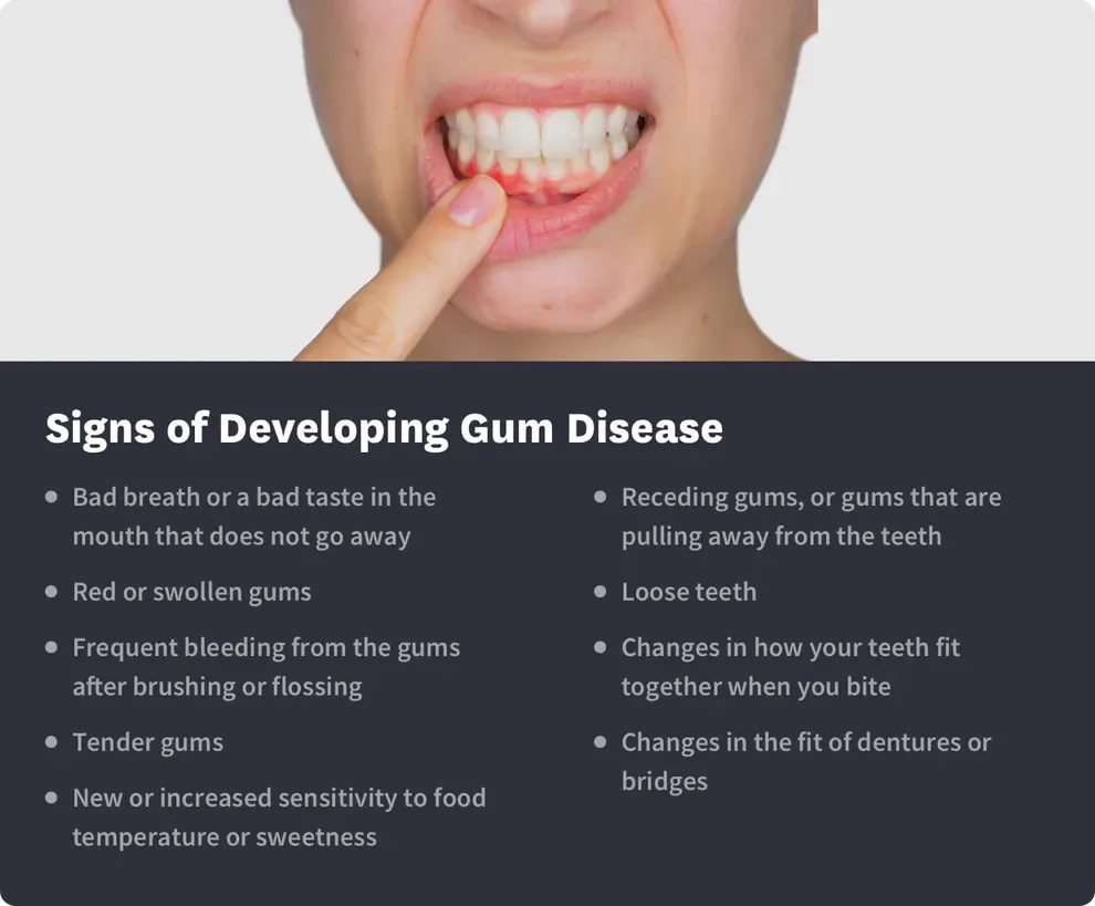 signs of developing gum disease