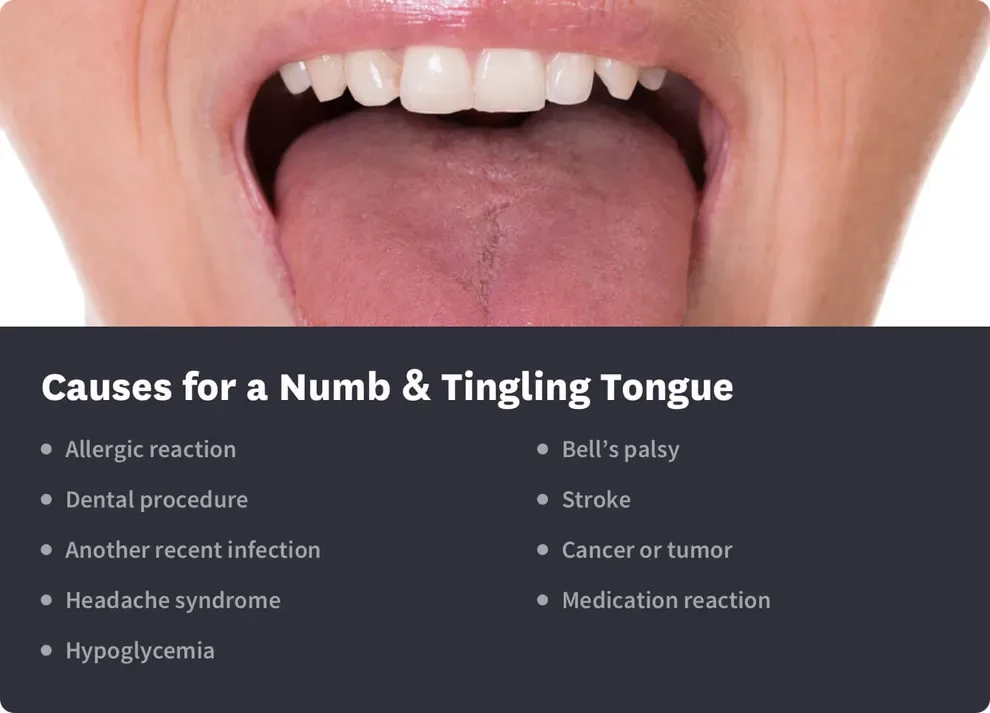 causes of a number or tingling tongue