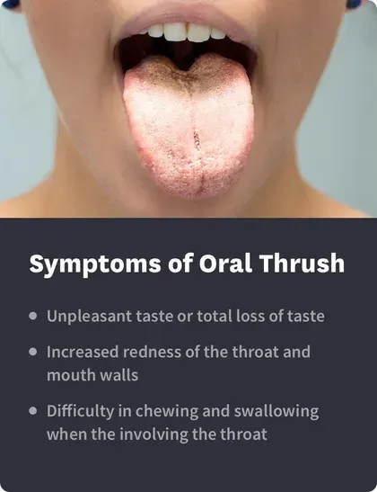 symptoms of oral thrush