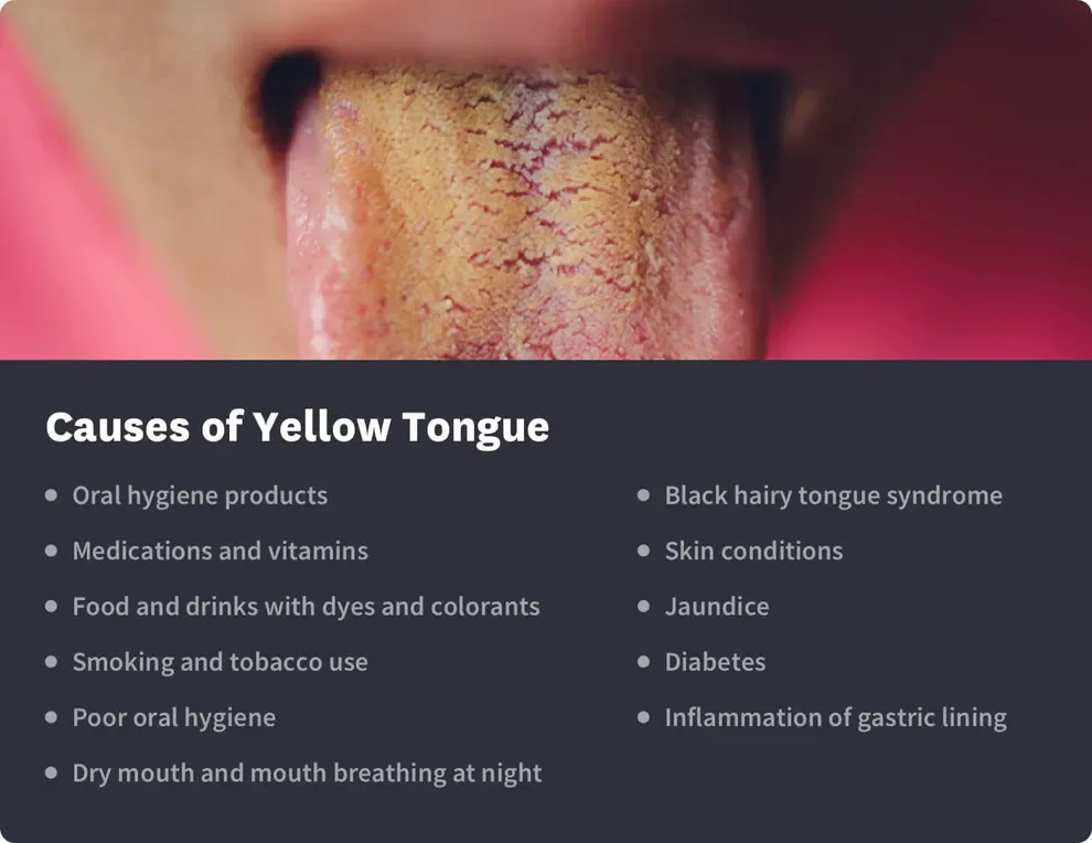 causes of yellow tongue