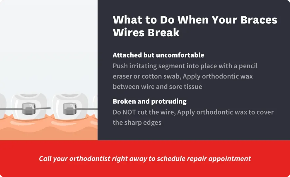 What to Do When Braces Break Byte®