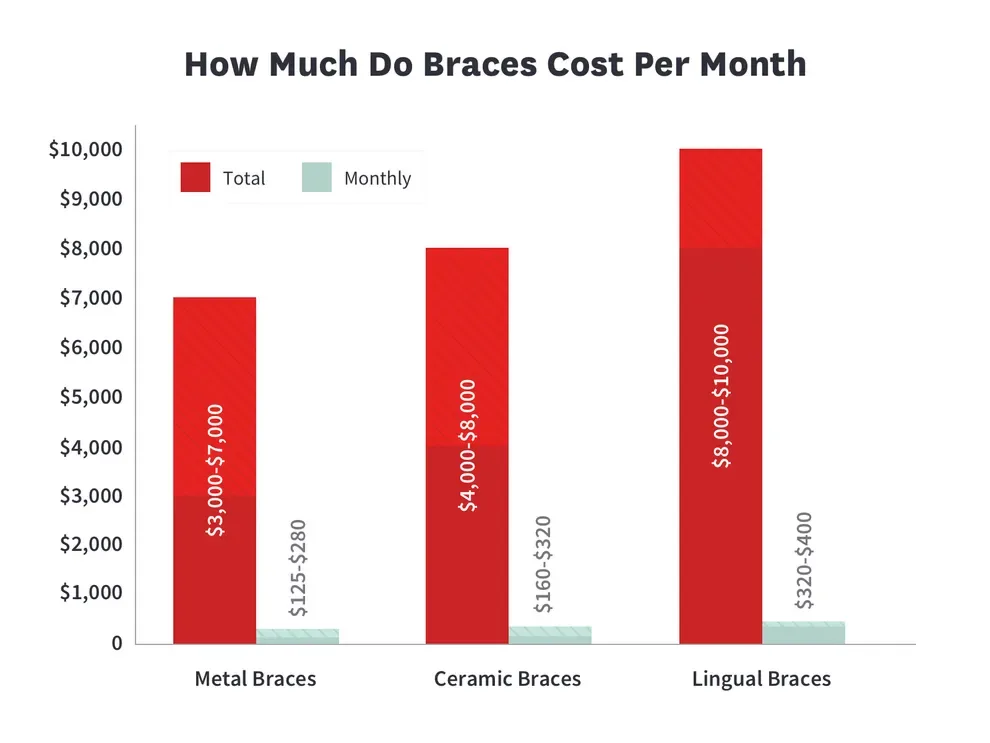 How much do braces cost in the USA? Price of braces in 2024 🦷