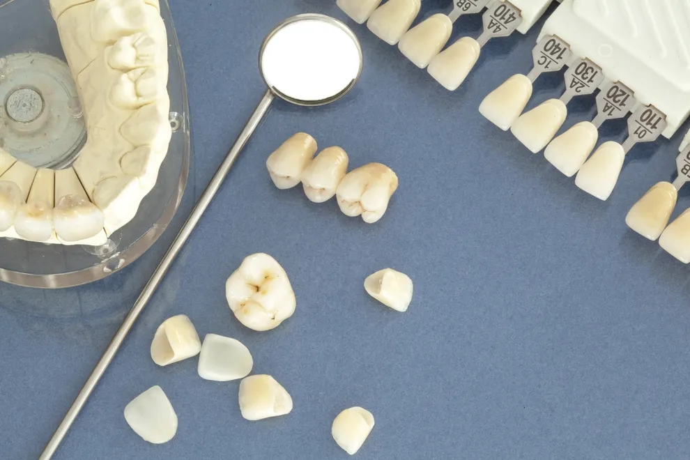 Crowns vs. Veneers Comparison of Costs & Benefits Byte® Byte®