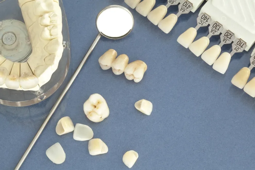 Crowns vs. Veneers Comparison of Costs & Benefits Byte® Byte®