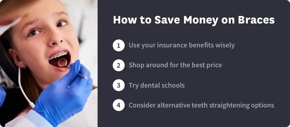How Much Do Braces Cost? - Oral-B