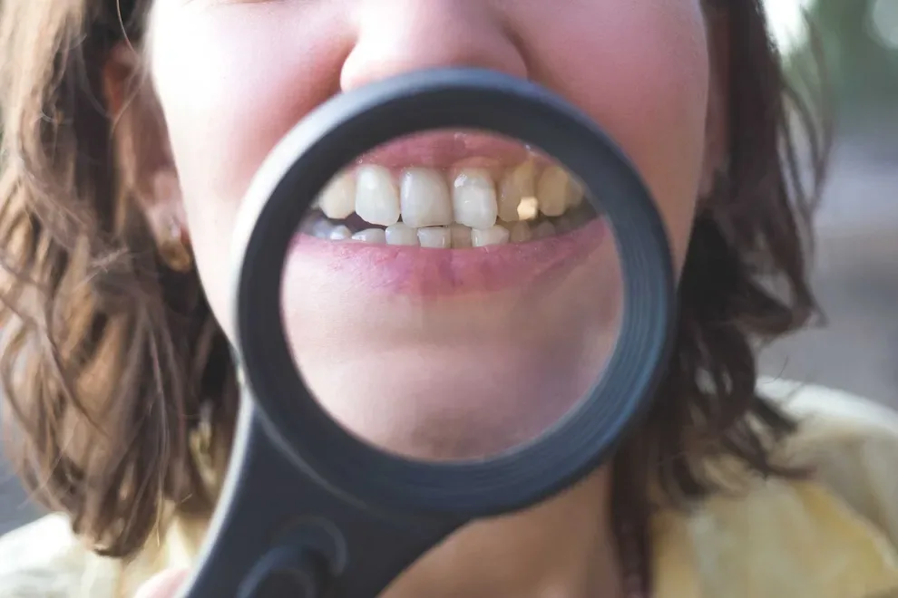 causes-of-misaligned-teeth