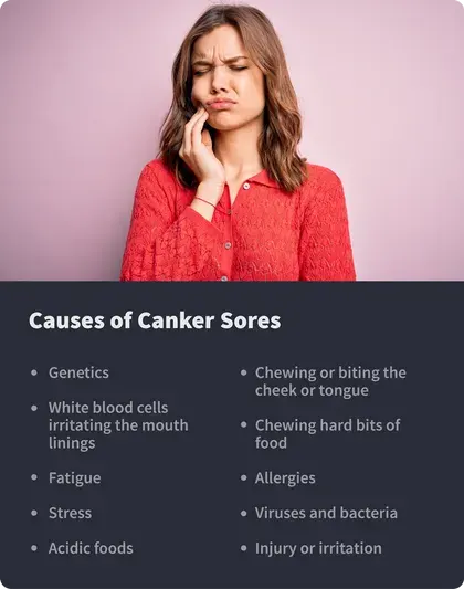 Causes of Canker Sores