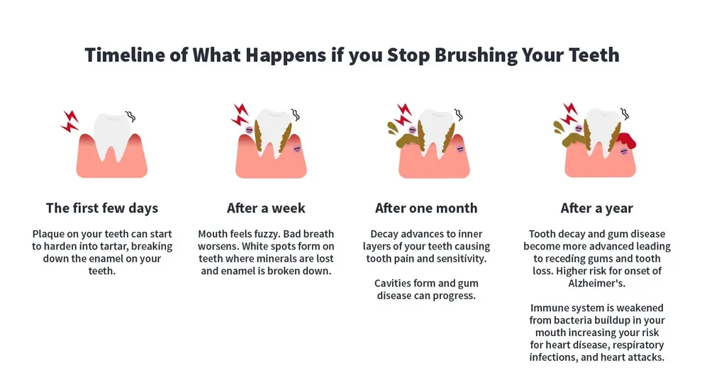 Timeline of What Happens if you Stop Brushing Your Teeth