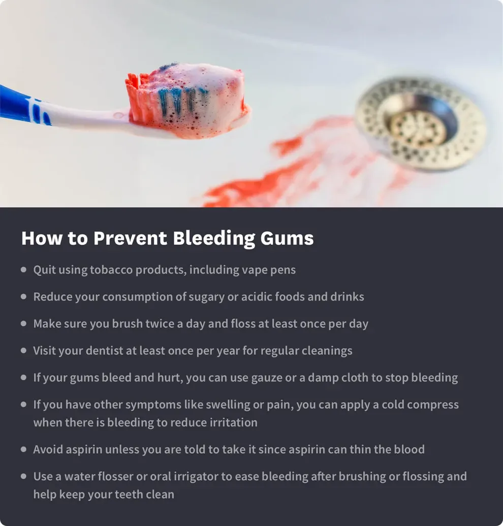 how to prevent bleeding gums