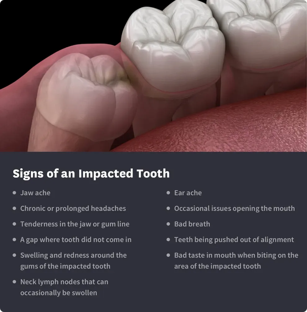 signs of an impacted tooth