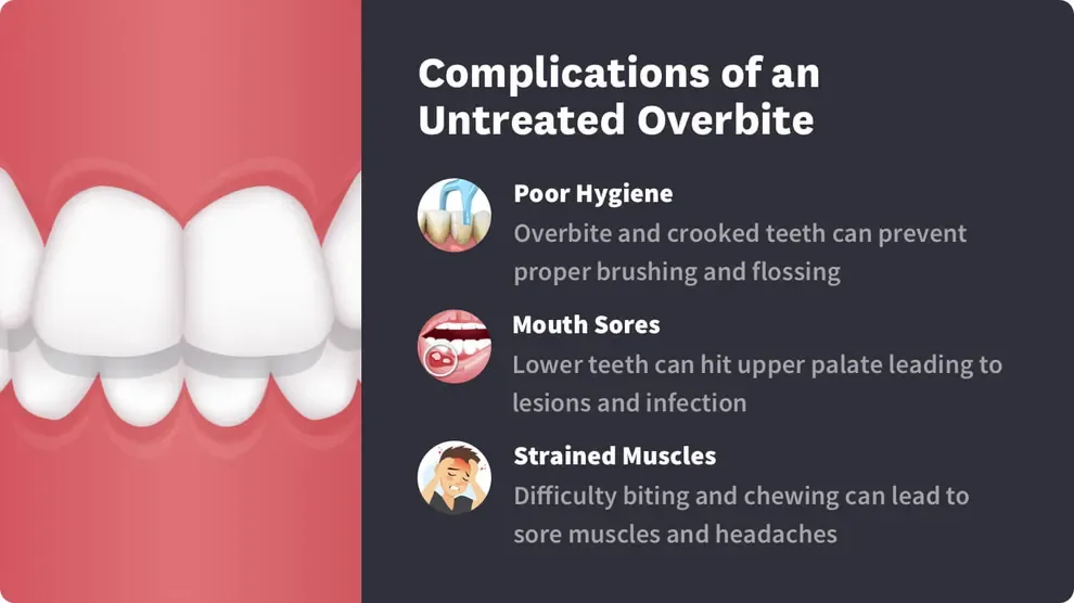 What is Overbite: Symptoms, Diagnosis and Treatment