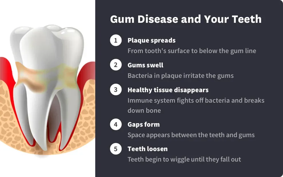 Gum Disease and Your Teeth