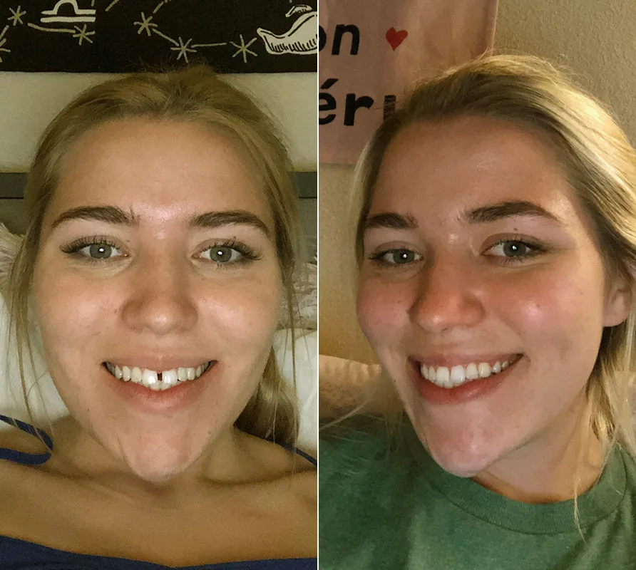 Byte Protection Plan Byte®