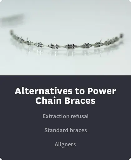 alternatives to power chain braces