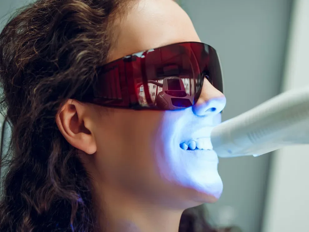 Does LED Teeth Whitening Work? Byte®