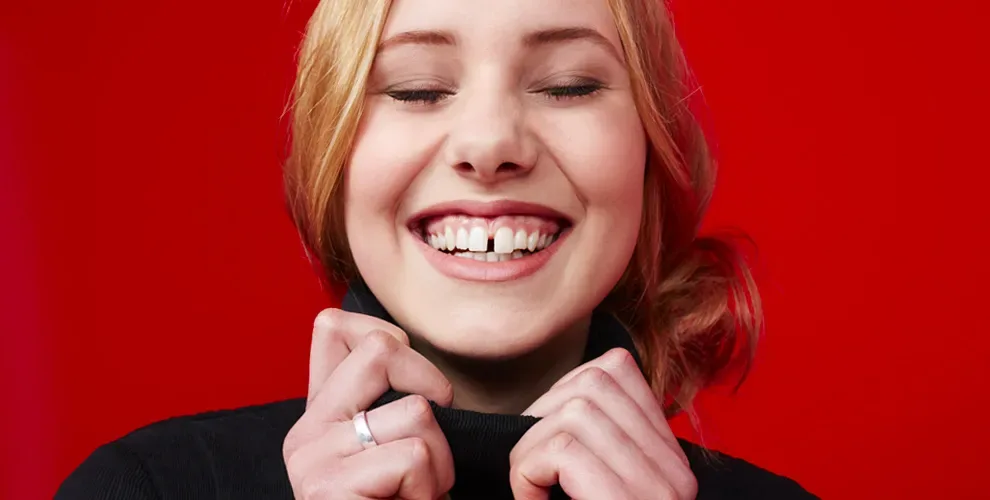 06_fix-teeth-gaps-without-braces