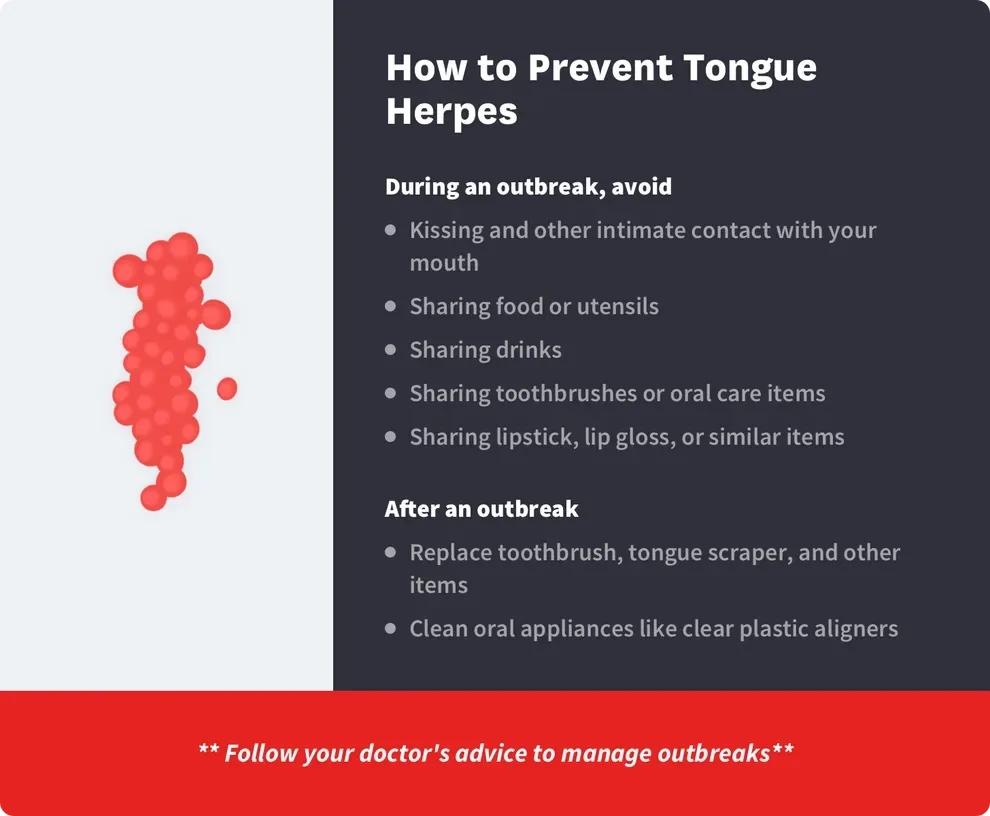 Tongue Herpes Causes, Symptoms & Treatment Methods Byte®