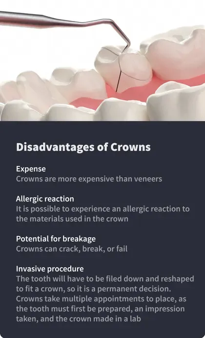 Disadvantages of Crowns
