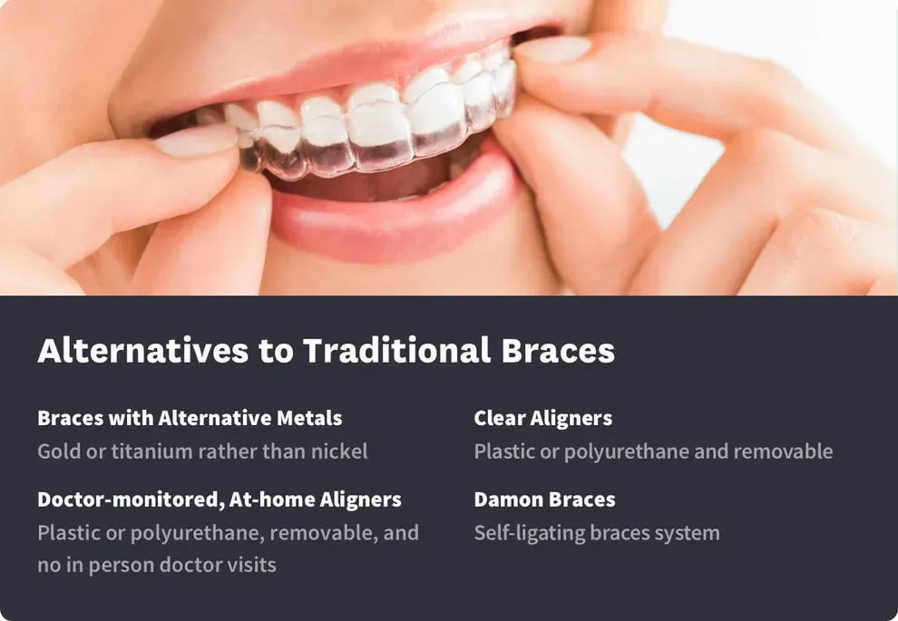Alternatives to Traditional Braces