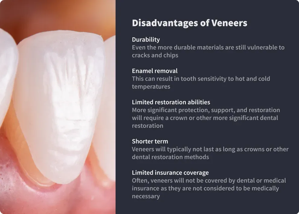 Disadvantages of Veneers