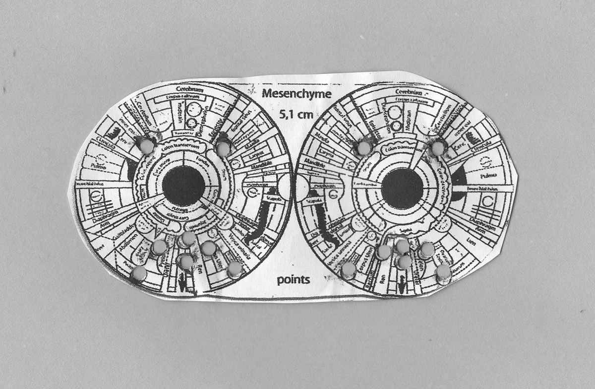 esogetic template