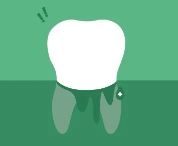 โรคเหงือกคืออะไร? - Image 1 - listerine.co.th - th-TH