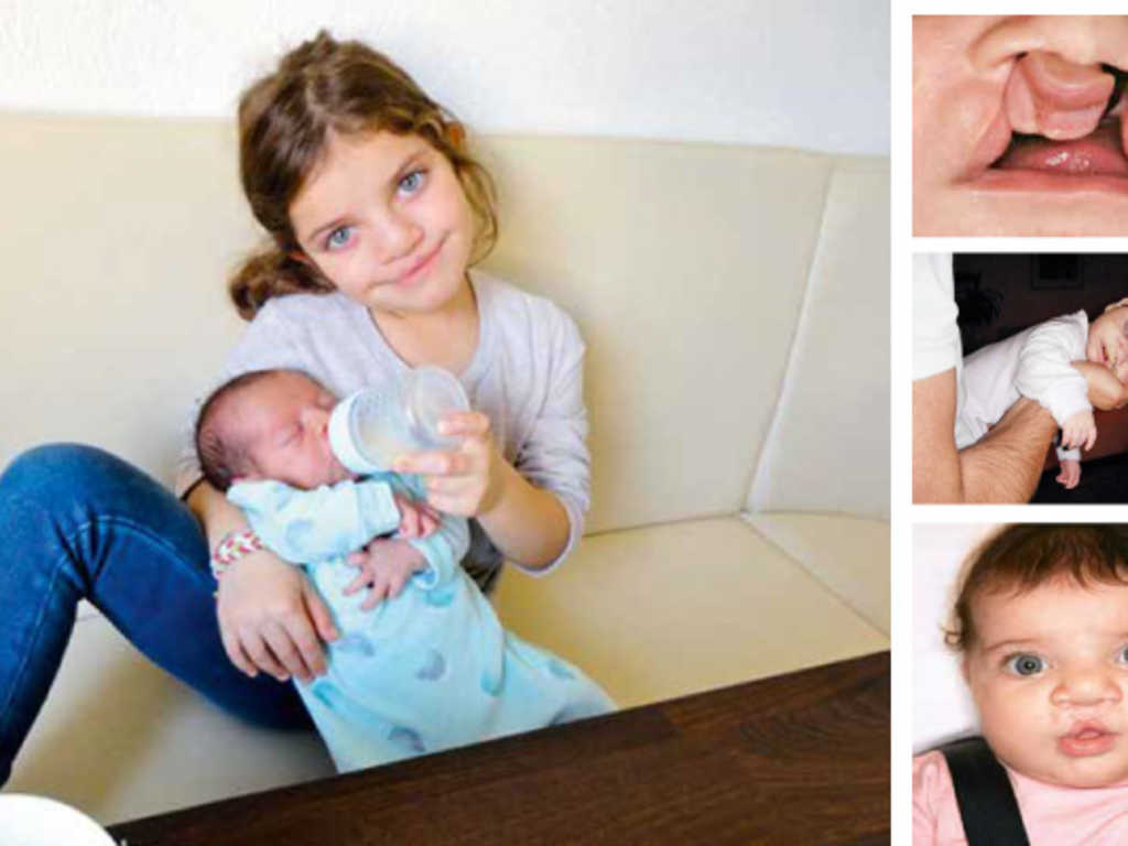 Perfekt Trotz Fehlbildung Wireltern Ch