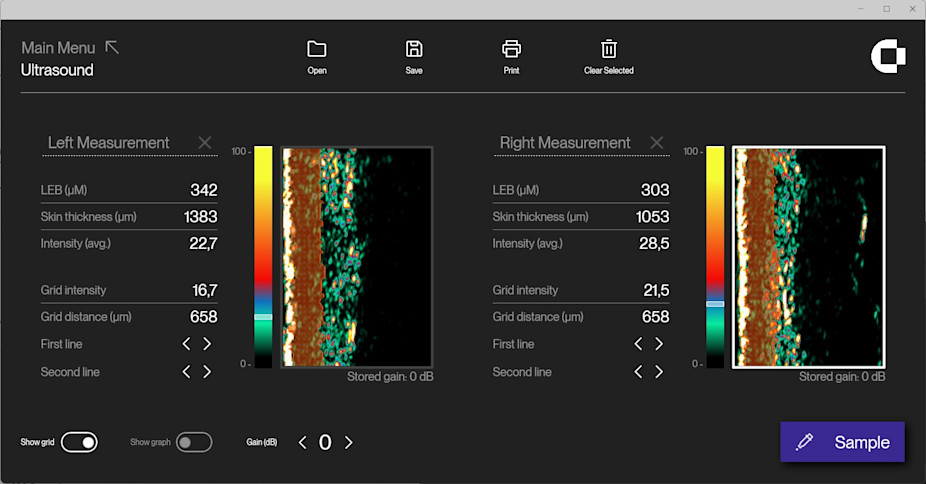 Ultrasound software - with grid