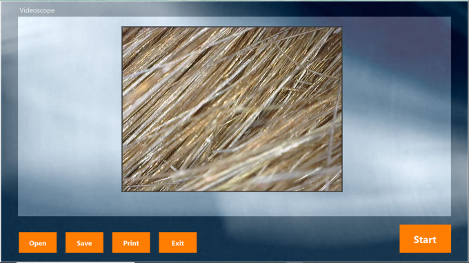 Dermascope Camera software hair