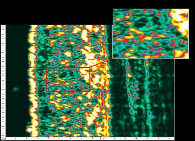 Foto Dermascan software high resolution images