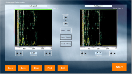 Ultrasound Subcutaneous Probe software