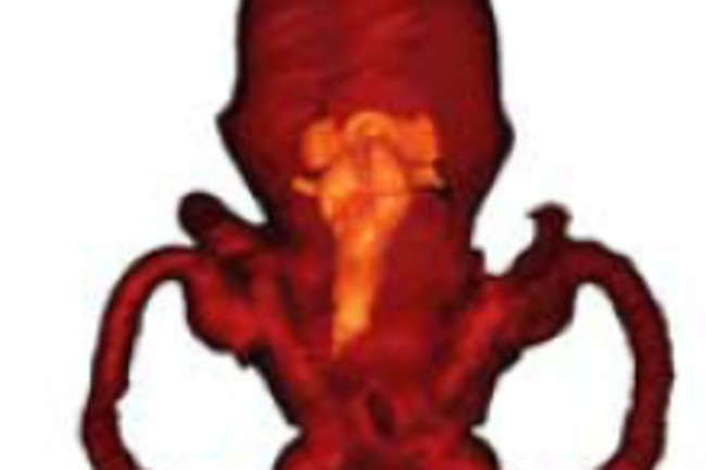dorasl-brain.jpg