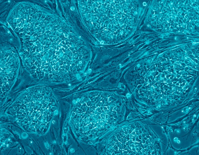 embryonic stem cells