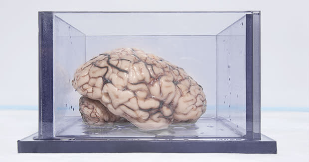 brainhm2.jpg