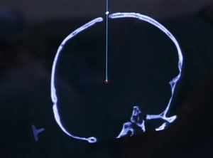 deepbrainsimulation