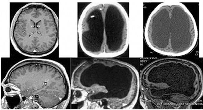 Brains - Forsdyke 2015 Biological Theory