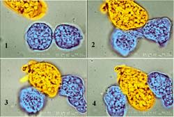 rd_amoeba.jpg