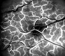 brain-blood-vessels.jpg
