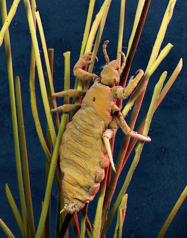 Head Louse - Science Source