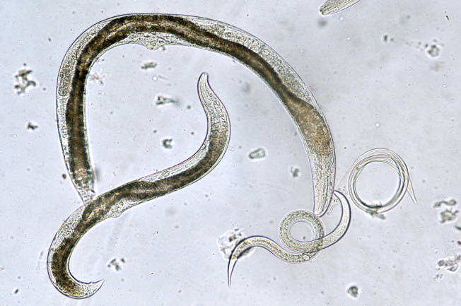 Worms And Humans Share The Same Life Prolonging Gene Discover Magazine