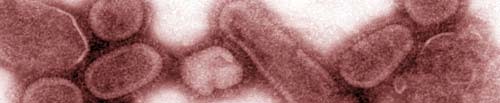 SpanishFlu.jpg