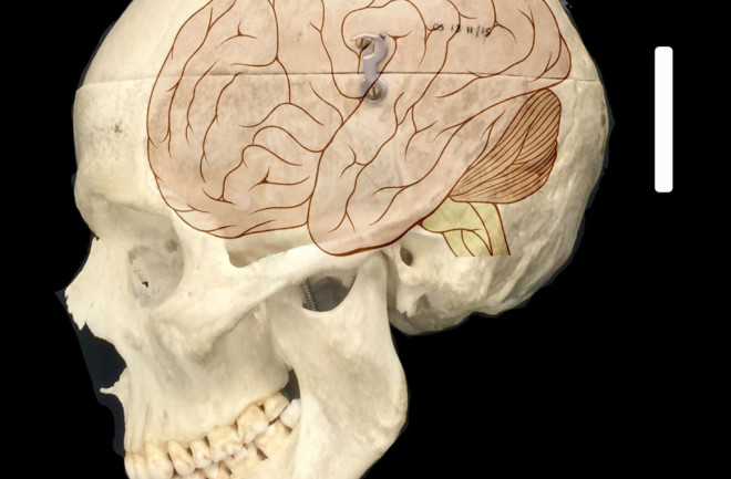 This-image-shows-a-human-skull-overlaid-with-an-illustration-of-the-human-brain-CREDIT-Fiddes-et-al-1024x1024.jpg
